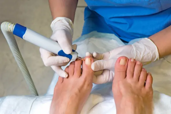 Nail Surgery Image