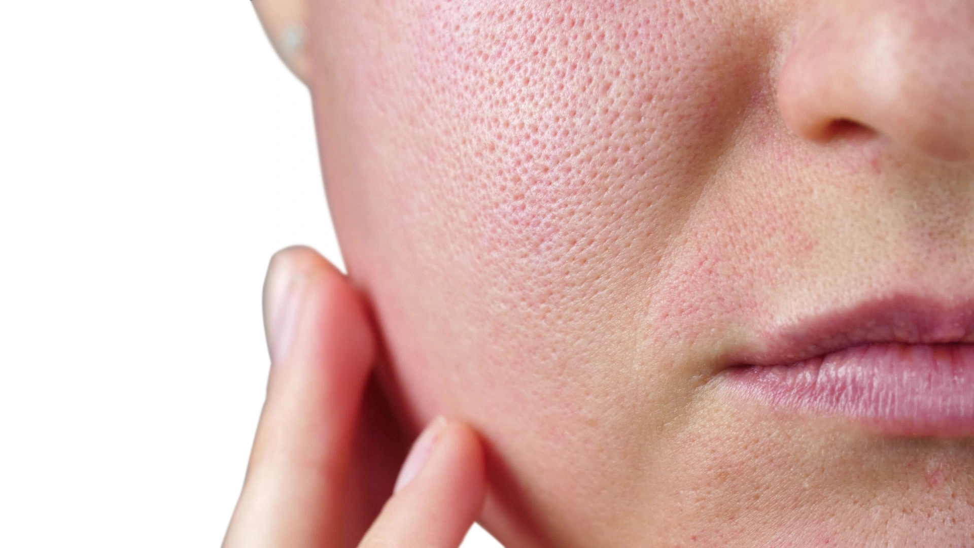 Skin Pores Treatment Image